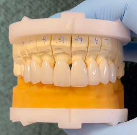 Patient-Centered Dentistry