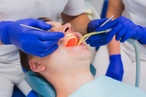 Emergency Root Canal in Newport Beach: Signs You Need Immediate Treatment